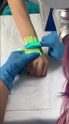 Technology uses infrared light to locate veins in patients