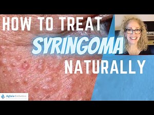 HOW TO TREAT SYRINGOMA (Natural Remedies & Medical Procedures)