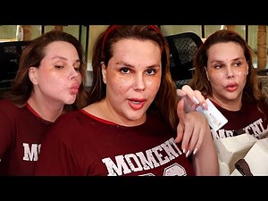 Wanessa Wolf conta que FOI AO DERMATOLOGISTA 💆🏼 O peeling deu ruim?