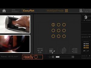 5a6997af177c1 quantel medical easyret user guide multispot