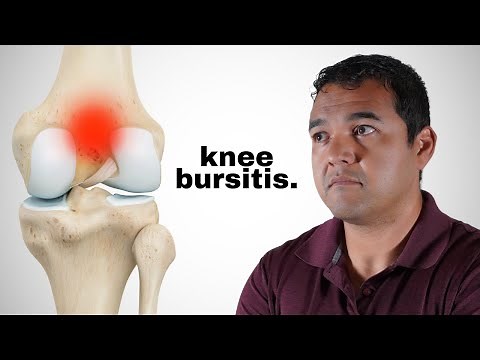 Knee Bursitis: Causes, Symptoms, and Treatment Options