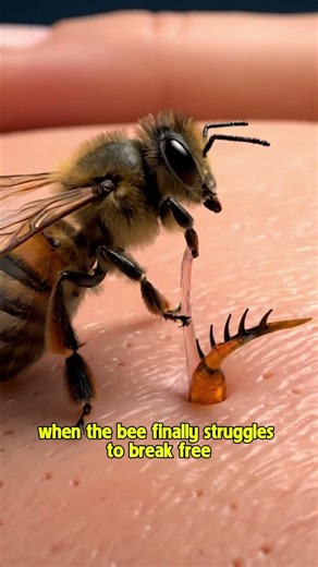 🐝A Bee’s Deadly Sting