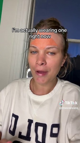 SOS Pimple Patches: The Ultimate Skincare Solution