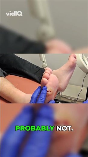 Big Foot Wound: Pressure and Rubbing Solutions 👣