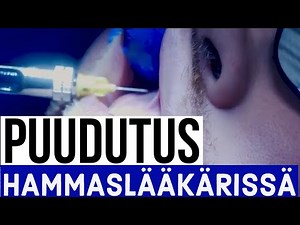 Puuduttaminen hammashoidossa - Hammaslääkäri kertoo