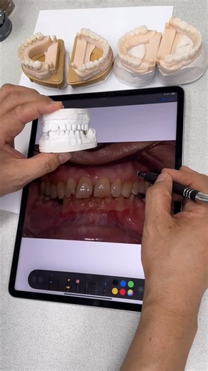 Luke Kahng on Instagram: "From Lab Planning for this case!"