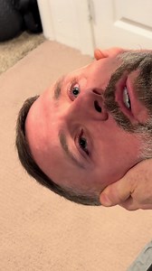 Torsional Nystagmus: Eye Movements in BPPV & Vertigo Explained