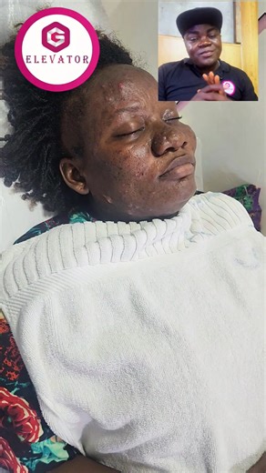 A very simple explanation, that miracles are still happaning..... Come and Visit the Testimony Skin Care Center | G Elevator