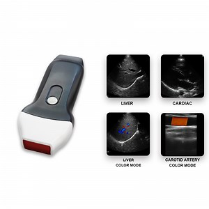 [Hot Item] C10XL Dual-probe imaging power Complete shallow and deep scans Wireless ultrasound Probe