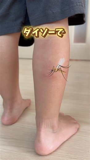 ダイソーのポイズンリムーバー、やってみたら治り早かったー🫢✨！#ダイソー #虫さされ#便利グッズ #夏