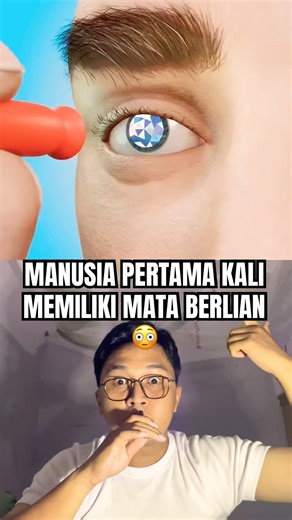 Mata berlian yang keren #thebaldheadnthedreadpodcast #eyes #doctor #lifestyle #anatomy