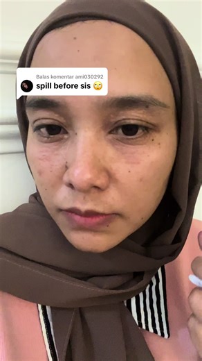 Syringoma Removal: Effective Solutions for Under-Eye Bumps