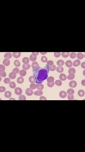 40K views · 735 reactions | Blood film #lablife #medicallaboratoryscience #hematology | Lab life | Facebook