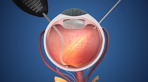 PRIMA System operating principle