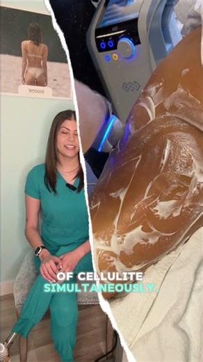 What is EMTONE - the perfect treatment for cellulite