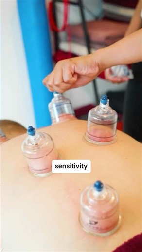 Myofascial Cupping And Muscle Relaxation