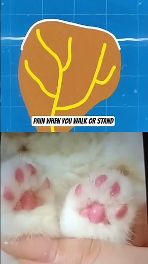 NEVER Rip Off That Painful Foot Bump! 😱 It's a Plantar Wart – Dermatologist Warning