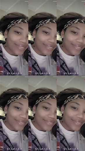 It's true, the full impact of a total hysterectomy with bilateral salpingectomy, including instant menopause symptoms like hot flashes, sweats, cramps, bloating, and shortness of breath, isn't discussed enough. Every experience is unique, but this definitely needs more open conversation! 🗣️ #Hysterectomy #Menopause #Recovery