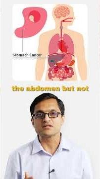 Definition and Cancers treated with CRS + HIPEC.