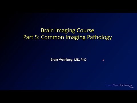 Brain imaging course – 5 – Common imaging pathology