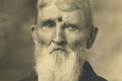 10 People Who Survived Being Shot in the Head