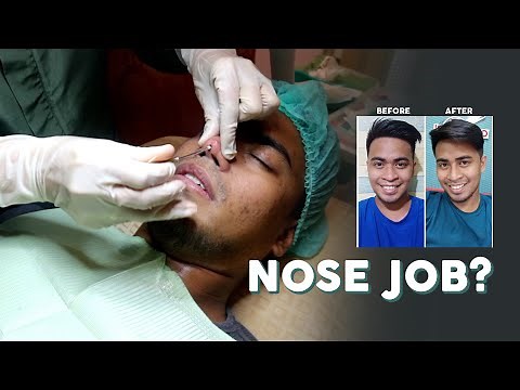 HIKO NON-SURGICAL NOSE THREAD LIFT | Derick Leynes