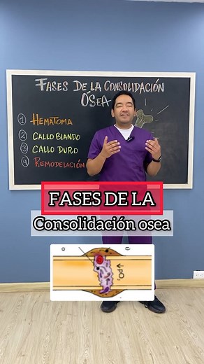 FASES de la consolidación osea. | GESCONS EDUCA