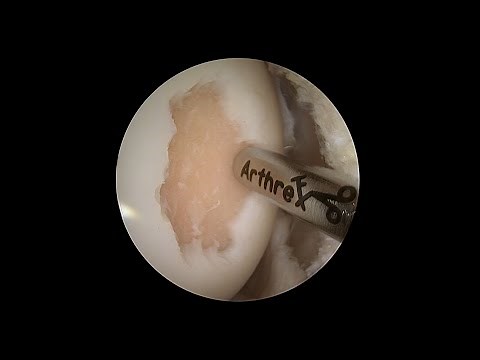 AutoCart™ Procedure: Scientific Support