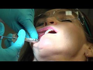Dental Hygiene Local Anesthesia 2011