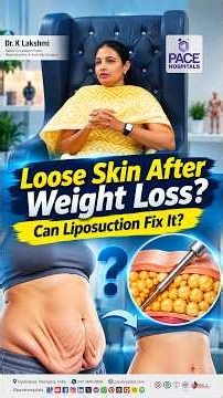 Loose Skin After Weight Loss? Liposuction for Excess Skin | Loose Skin Tightening Treatment