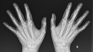 Time to throw away your keys and wallet