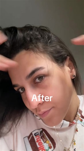 VT Cosmetics Reedle Shot: Hair Growth Solutions