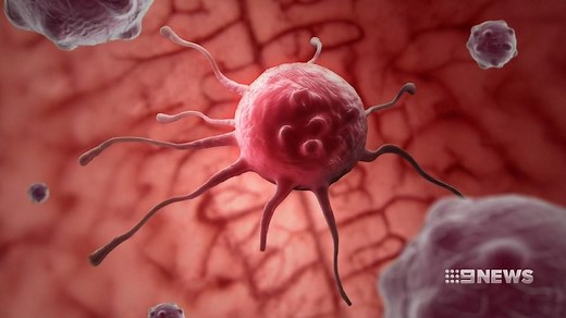 There's been a breakthrough in the underlying cause of ‘chemo brain’ and the treatment could be as simple as taking an aspirin. #9News | http://9News.com.au | 9 News