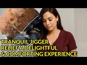 Tranquil Jigger Relief | A Delightful & Comforting Experience