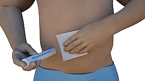 Stoma Waste Capture Device - 10-Pack (7/8"), Disposable Stoma Capture Cartridge for Any Type of Ileostomy, Urostomy, Colostomy Stoma Pouch Change, Skin Protection, and Leakage Prevention…