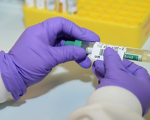 Laboratory Services - South Eastern Health & Social Care Trust