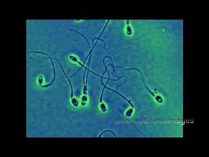 Human Sperm Under the Microscope