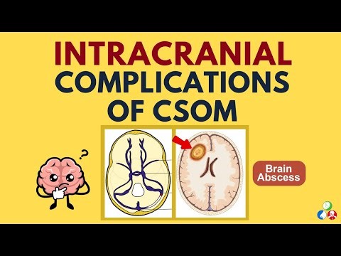 Intracranial Complications of Chronic Suppurative Otitis Media (CSOM) | Part 3