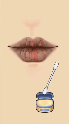 Lip Deep Cleaning ASMR 👄 #shorts