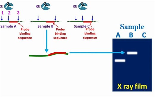RFLP - Restriction Fragment Length Polymorphism