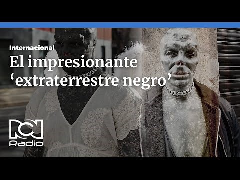 Anthony Loffredo: El hombre que quiere ser un ‘extraterrestre negro’