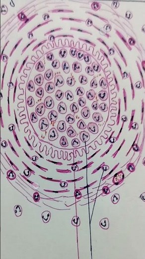 Buerger's disease histopathology