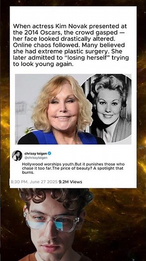 actress kim Novak then and now surgery ruined her face.