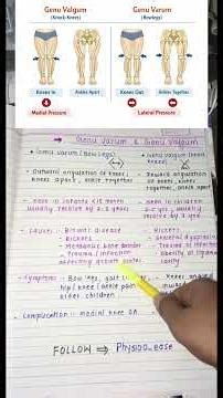 understanding genu varum and genu valgum#physiotherapist#medicalstudent#physiohub#explore#viral reel
