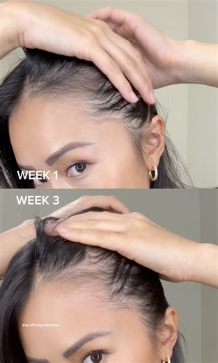 Pantene Pro-V on Instagram: "3 week update using our NEW Abundant & Strong Collection with @fionaleona_ 👀 See the results for yourself! #AbundantAndStrong #Pantene #AntiHairLoss"