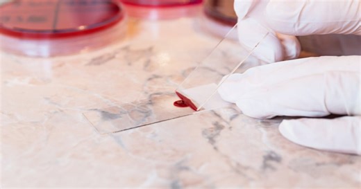 What you should know about the FDA's newly-approved sickle-cell treatment