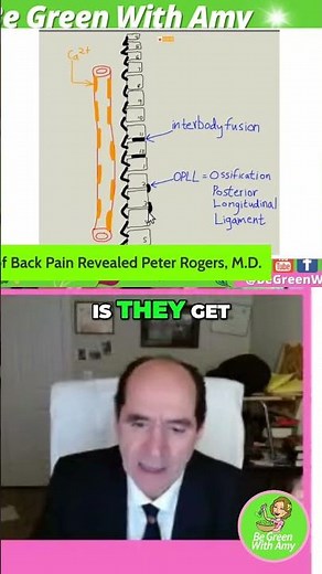 Spine Diseases: Peter Rogers MD #shorts