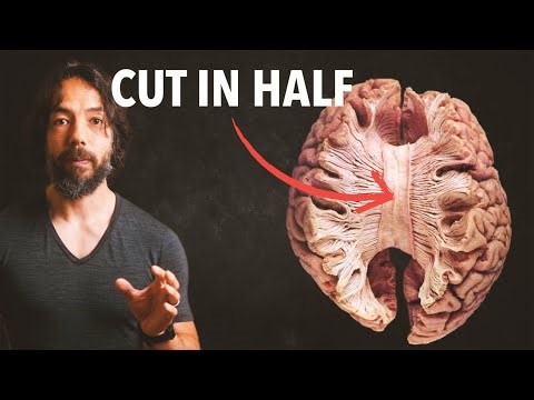 The Truth About Human Consciousness: The Split Brain Experiment