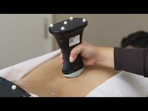 Real-Time 3D Spine Imaging with AI Ultrasound | SpineUs™