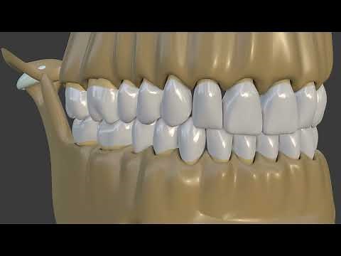 Occlusion: Canine guidance vs Group function